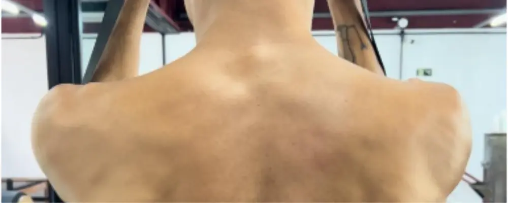 Fisioterapia para Ombro: Recuperação e Alívio de Dor 1 Fisioterapia para ombro