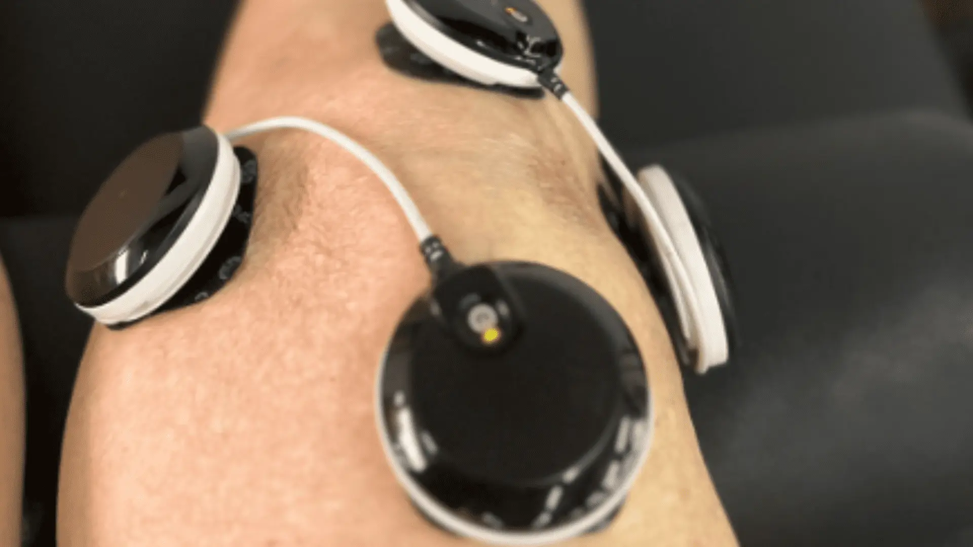 Fisioterapia para Artrose no Joelho: Benefícios e Tratamentos 5 Artrose no Joelho