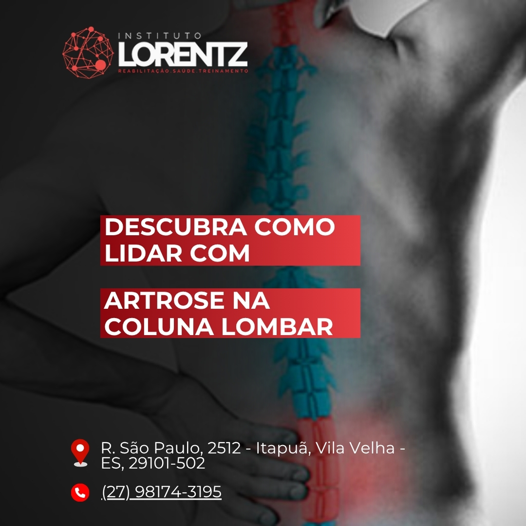Descubra-Como-Lidar-com-Artrose-na-Coluna-Lombar