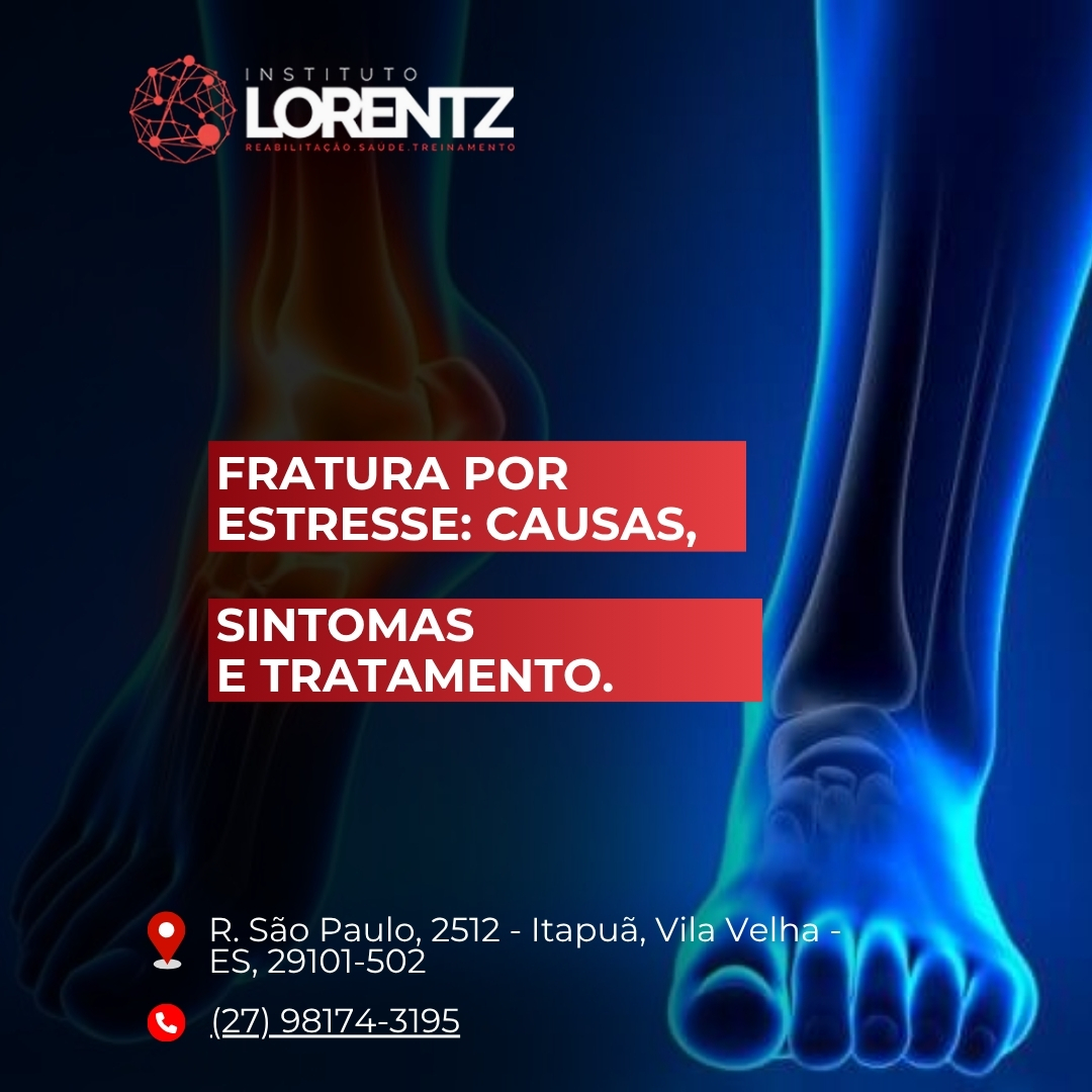 Fratura/por/estresse/Causas/sintomas/e/tratamento.