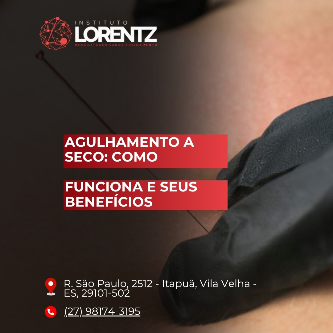 Agulhamento/a/Seco/Co/o/Funciona/e/Seus/Benefícios