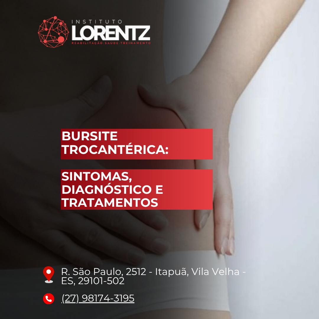 Bursite-Trocantérica-Sintomas-Diagnóstico-e-Tratamentos Bursite/Trocantérica/Sintomas/Diagnóstico/e/Tratamentos