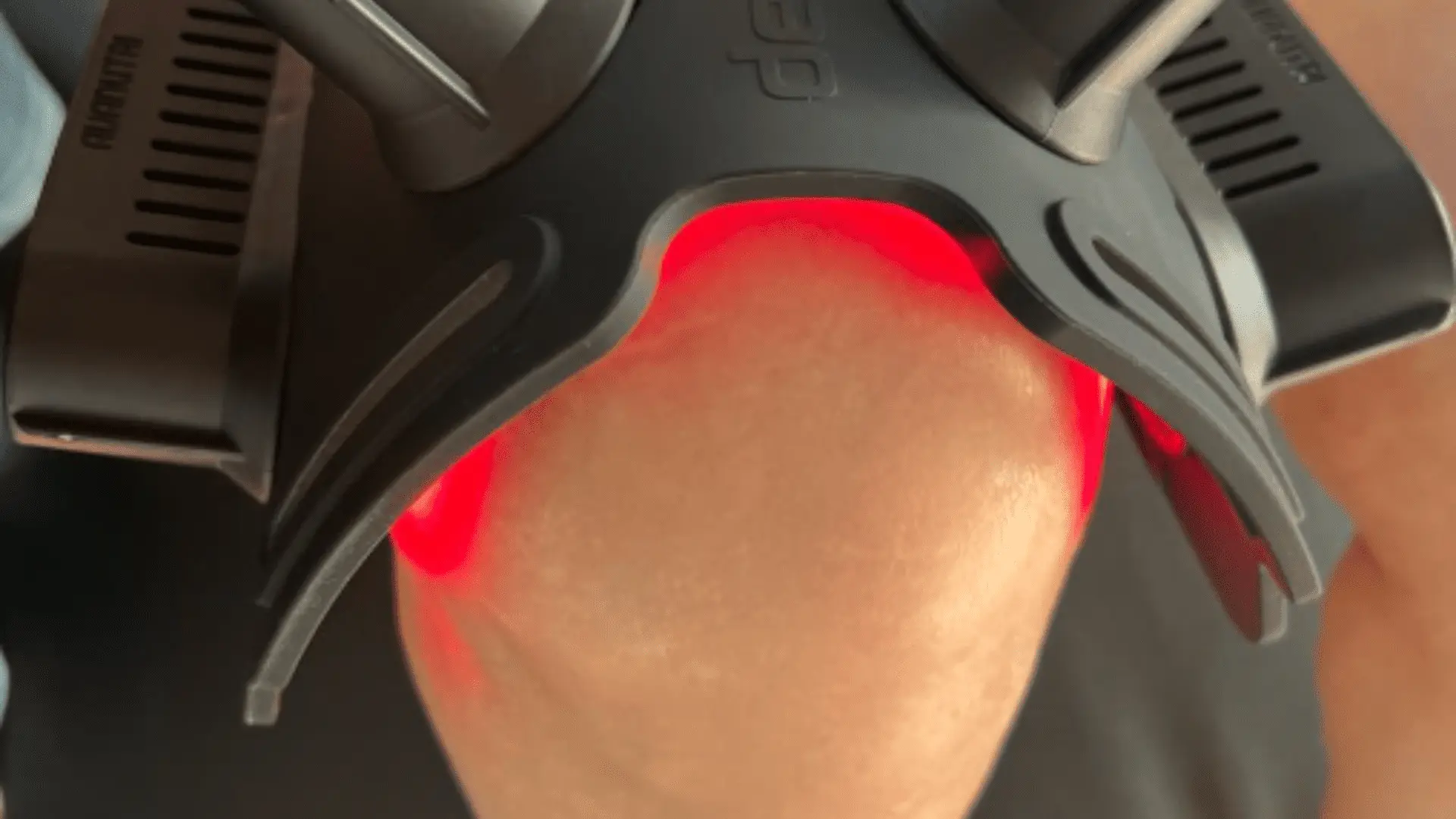 Qual o Valor de uma Sessão de Fisioterapia? 1 Valor da sessão de fisioterapia